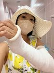 真夏の腕ギプス　アメ横散策